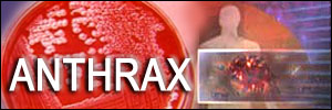 anthrax-cbc_canada